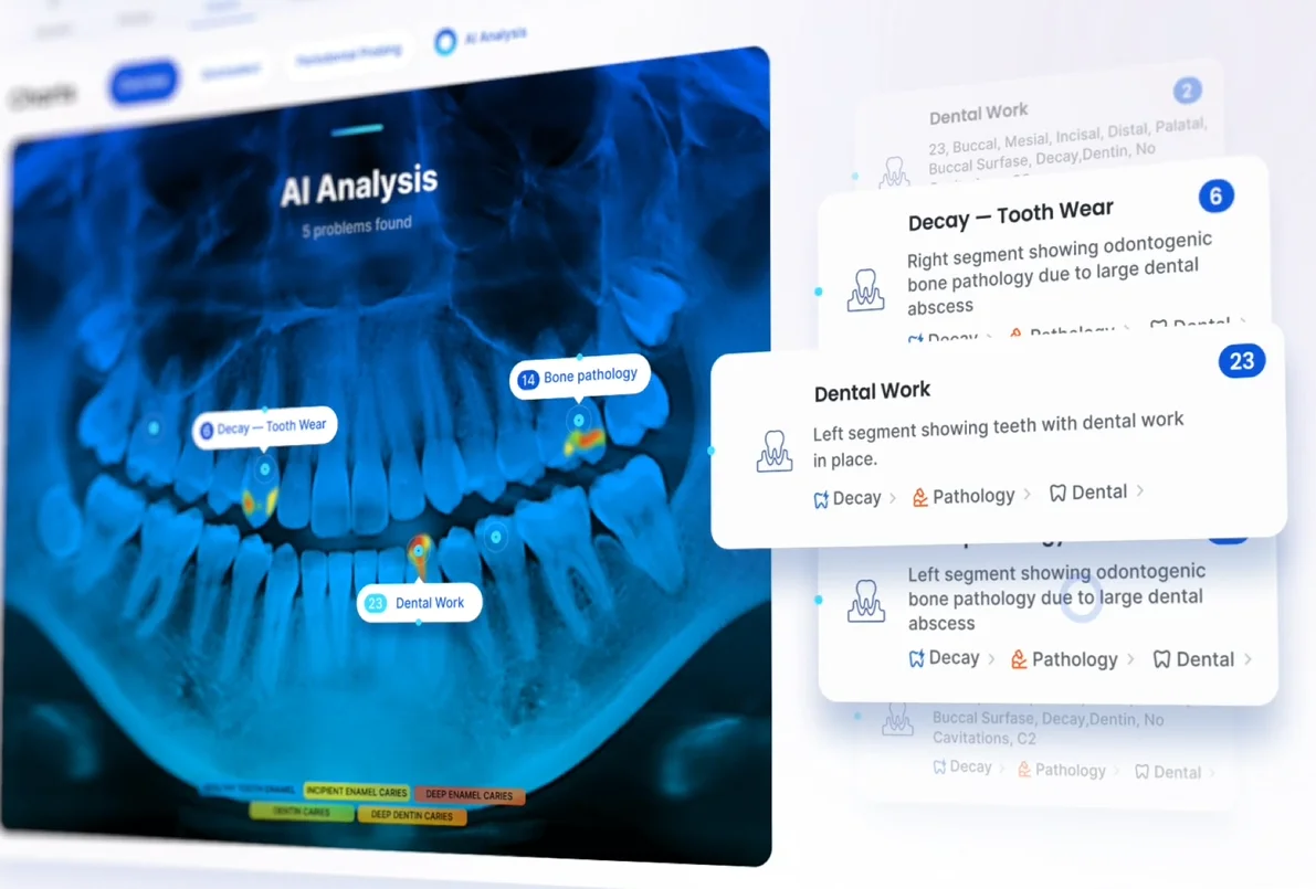 AI dental analysis